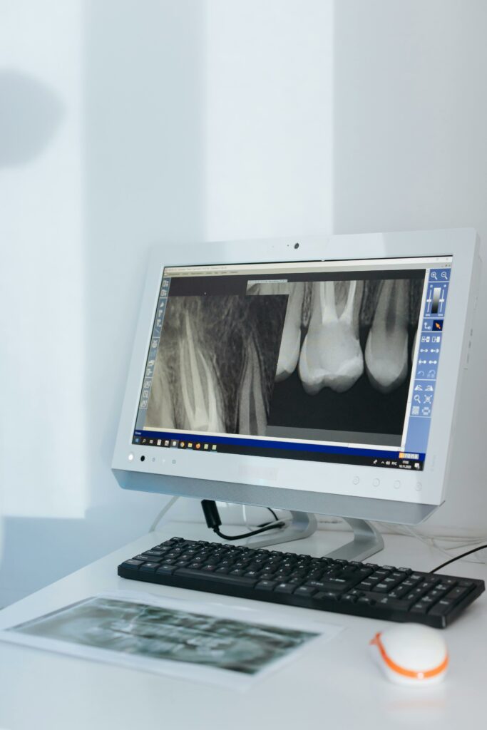 Écran affichant la radiographie dentaire d’un patient à Marseille.